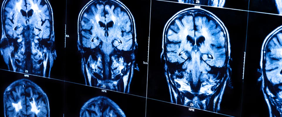 x-ray images of a head